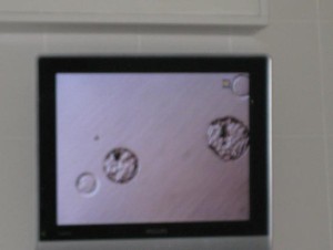 embryo transfer abroad